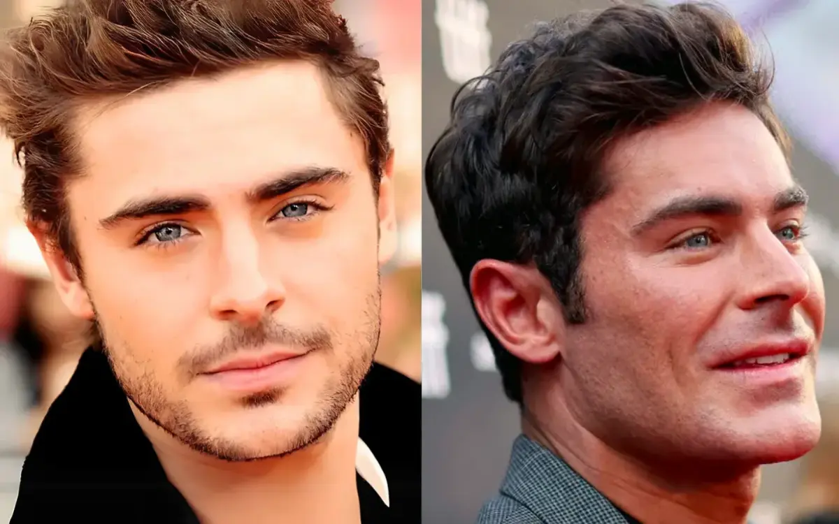 Antes e Depois de Zac Efron O Acidente Que Mudou Tudo